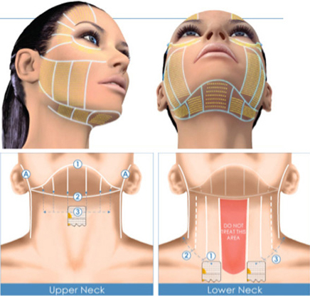 căng da cổ giá bao nhiê width=