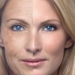 Phẫu thuật căng da mặt – Bí quyết làm đẹp da cho phụ nữ sau tuổi 30